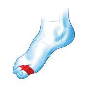 Διαχωριστικό δακτύλων