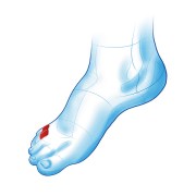 Διαχωριστικό δακτύλων